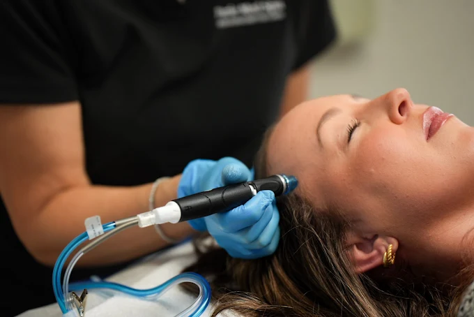 How to Treat Adult Acne with Professional Treatments